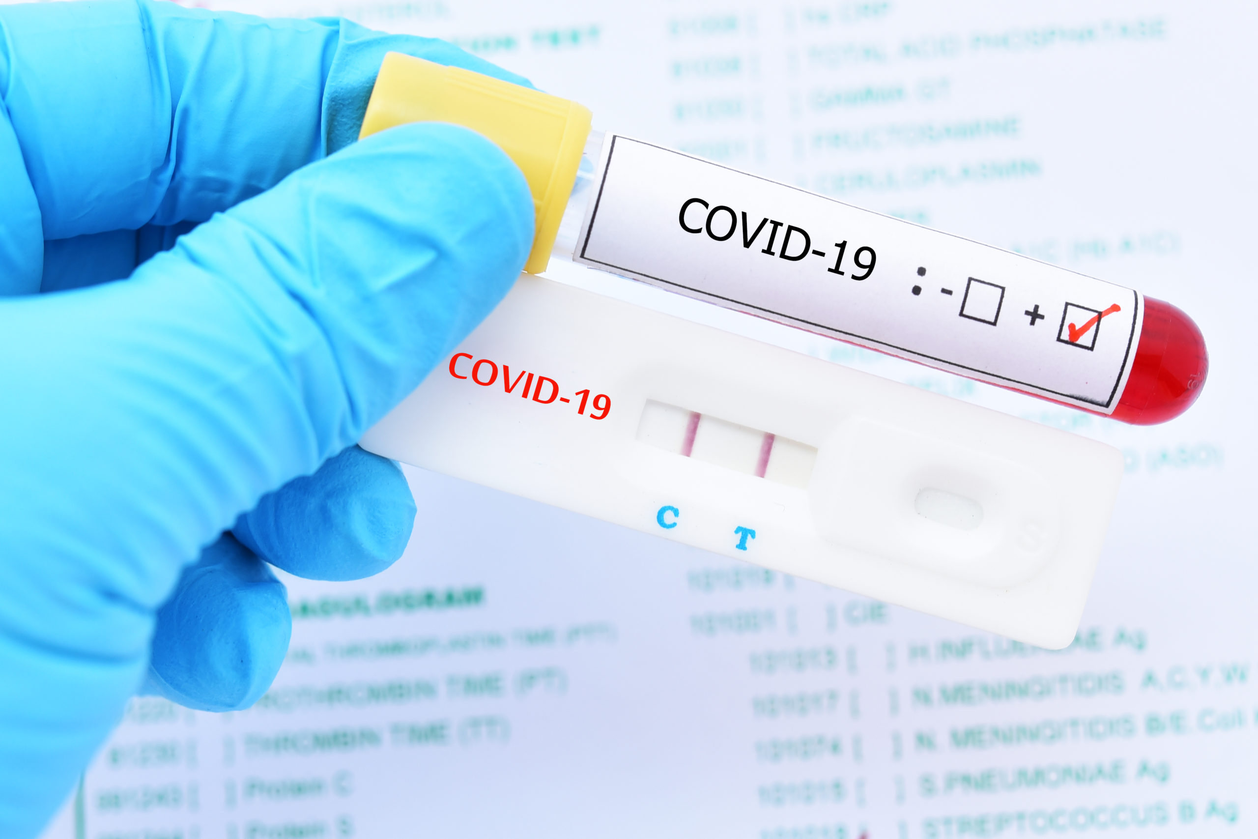 Salud Pública reporta un fallecido por coronavirus