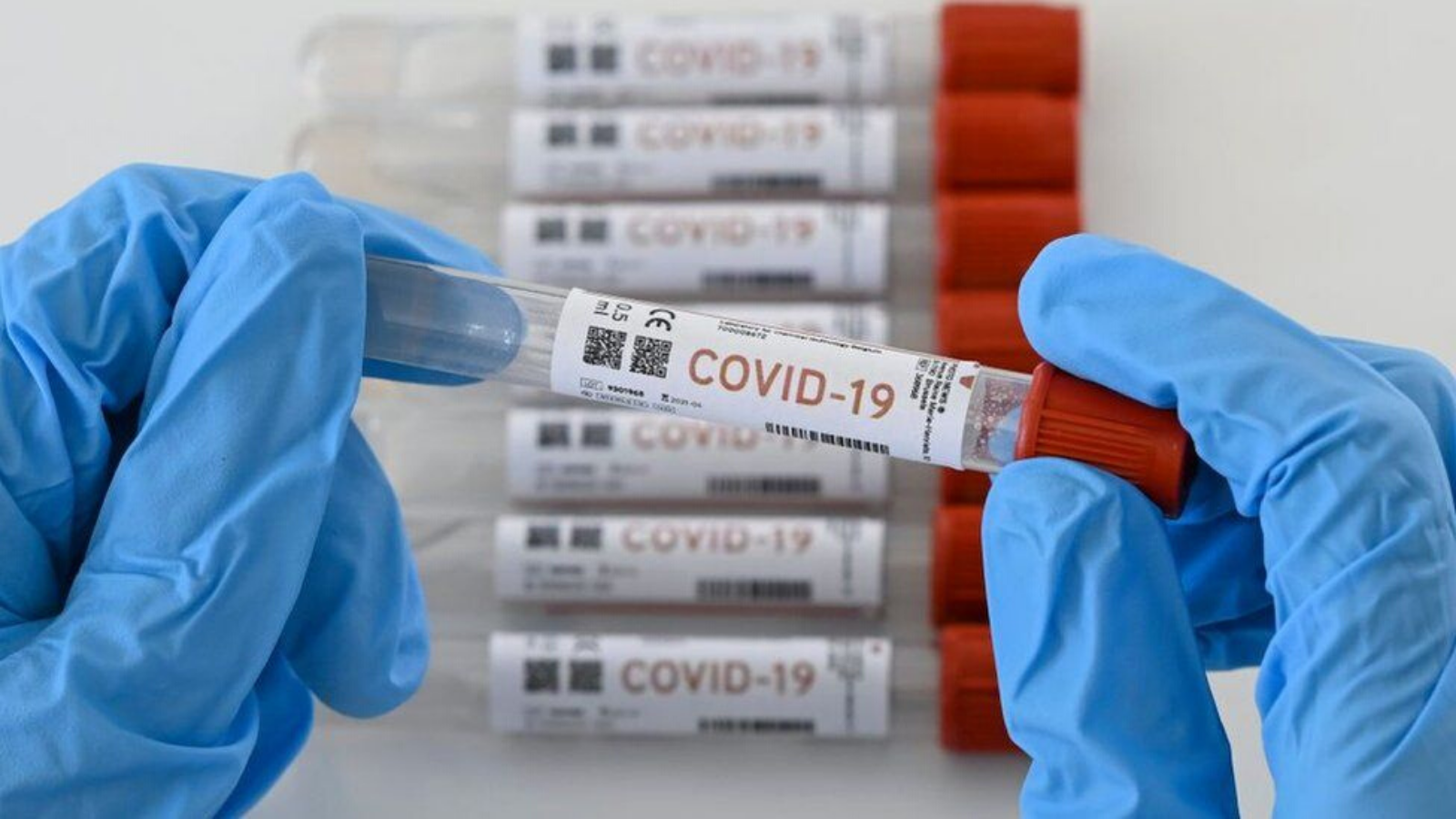 Descienden casos de COVID-19 en RD, autoridades de salud reportan 165 casos y cuatro muertes
