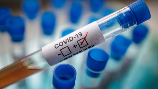 Tres muertos por coronavirus en RD, ninguno ocurrió en las últimas horas